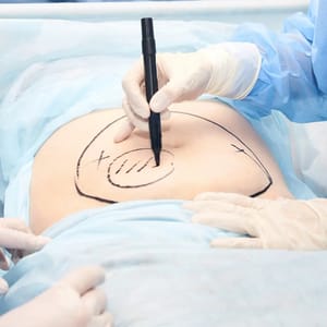Surgery