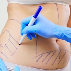 Plastic Surgery Treatment Options