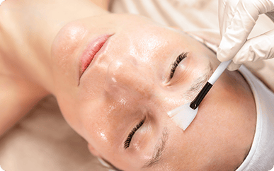 Peels to Reveal Brighter, Smoother Skin