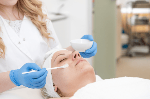 chemical peel session