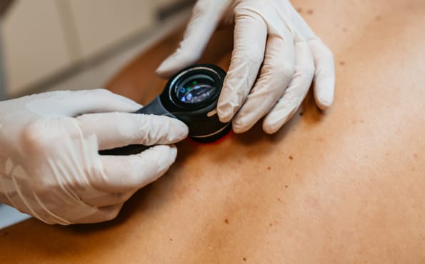 Dermatologist examining a patient's skin with a dermatoscope