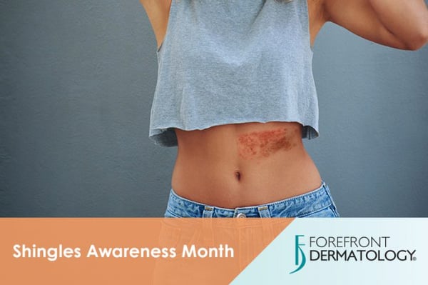 Shingles Awareness Month