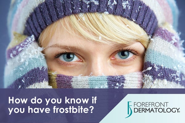 How to Tell if You Have Frostbite (And What to Do About It)