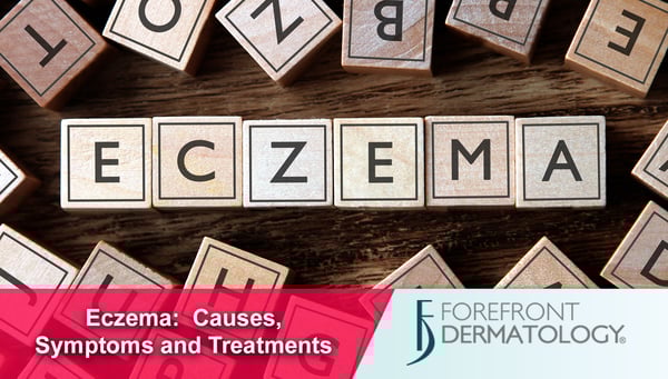 About Eczema: Causes and Symptoms