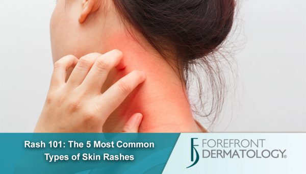 Rash 101: The 5 Most Common Types of Skin Rashes