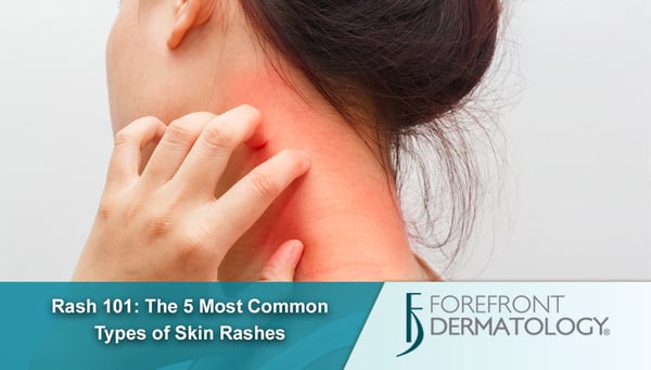 Rash 101: The 5 Most Common Types of Skin Rashes