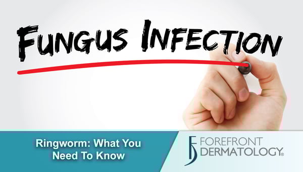 Ringworm: What You Need to Know
