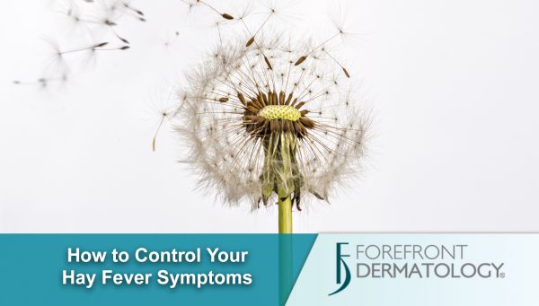 6 Tips to Help Control Your Hay Fever Symptoms