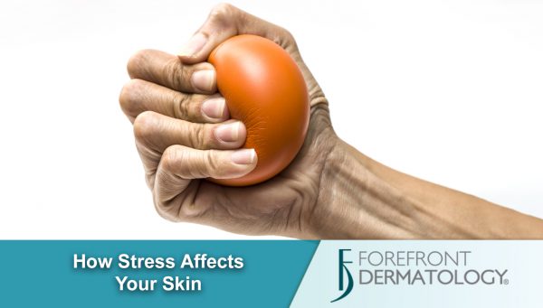 The Stress Effect – How Stress Impacts Skin Health