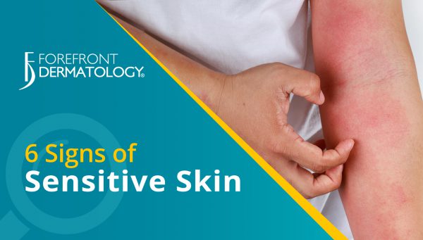 6 Signs You Have Sensitive Skin - Forefront Dermatology