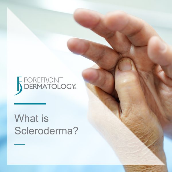 What is Scleroderma?