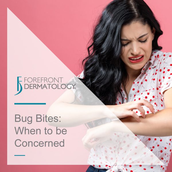 Bug Bites: When to be concerned