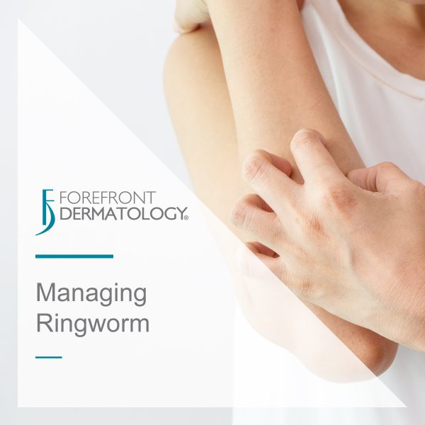 Managing Ringworm