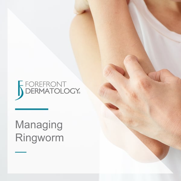 Managing Ringworm