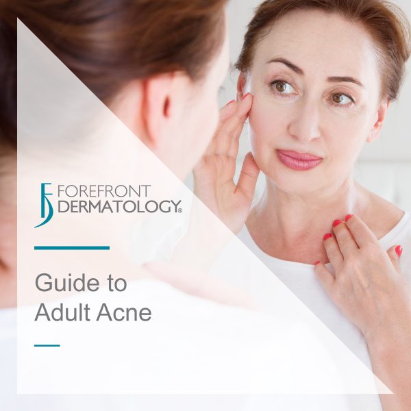 Guide to Adult Acne - Forefront Dermatology