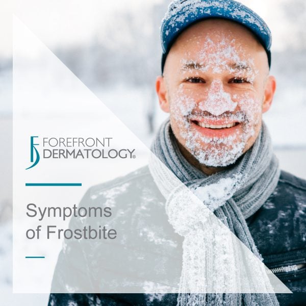 Symptoms of Frostbite