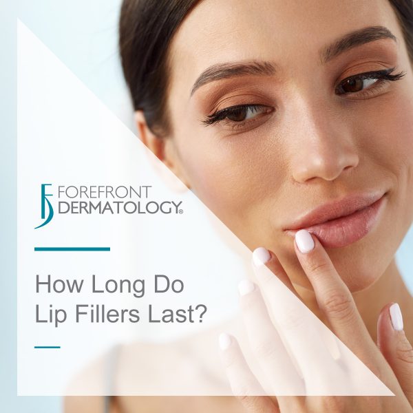 How Long Do Lip Fillers Last?