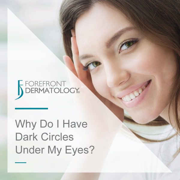 Why Do I Have Dark Circles Under My Eyes?