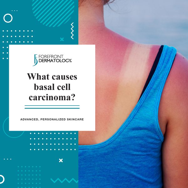 What Causes Basal Cell Carcinoma? | Forefront Dermatology
