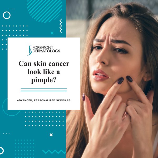 Can Skin Cancer Look like a Pimple? | Forefront Dermatology