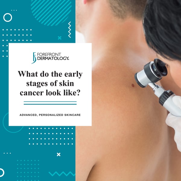 What Do The Early Stages of Skin Cancer Look Like? | Forefront Dermatology
