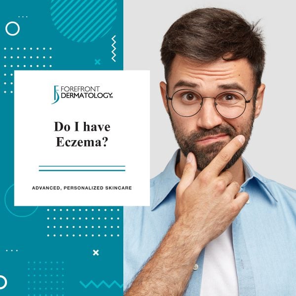 Do I Have Eczema?
