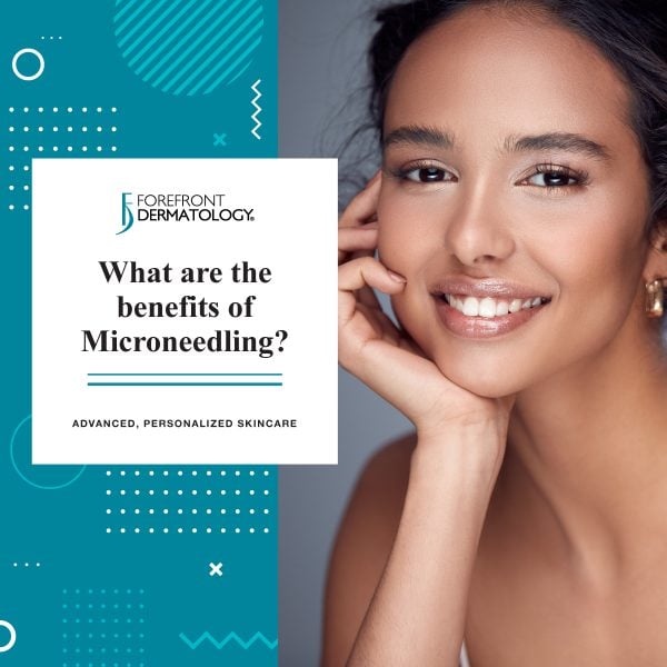 What are the Benefits of Microneedling?