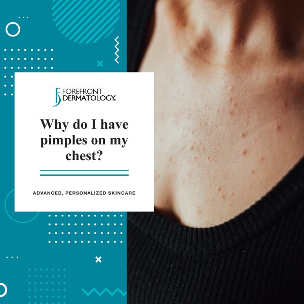 Why Do I Have Pimples on My Chest? - Forefront Dermatology