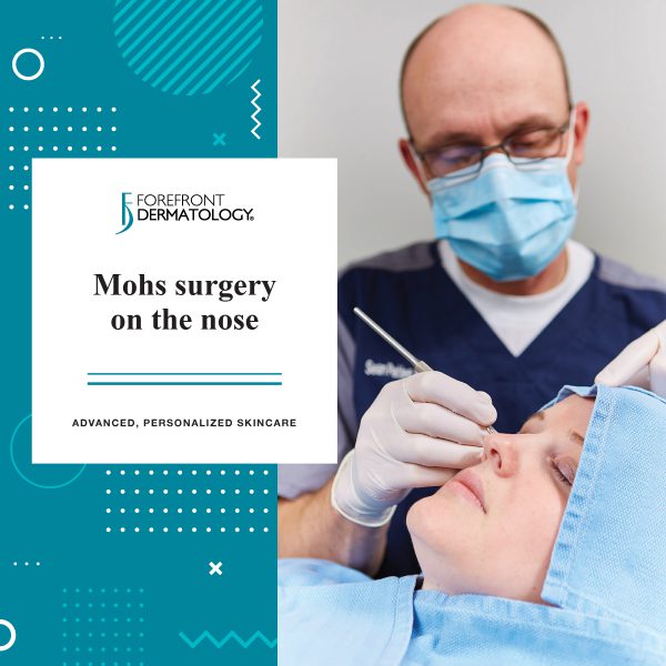 Mohs Surgery on the Nose - Forefront Dermatology