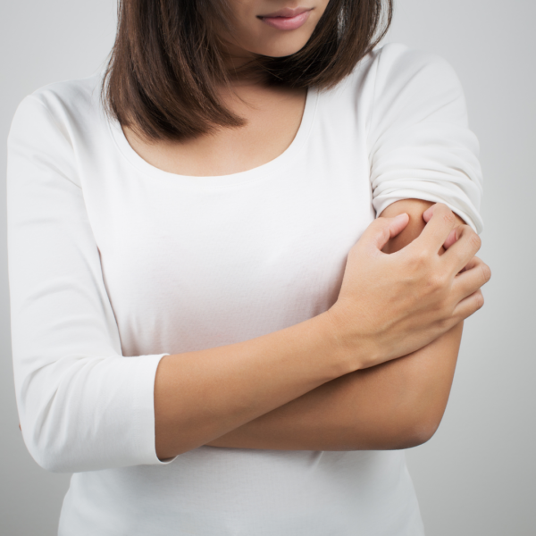 What is Keratosis Pilaris?