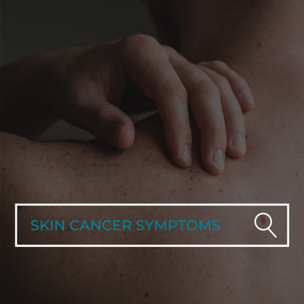 How Do You Know If You Have Skin Cancer?