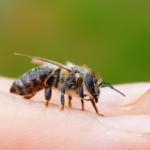 How to Treat a Bee Sting