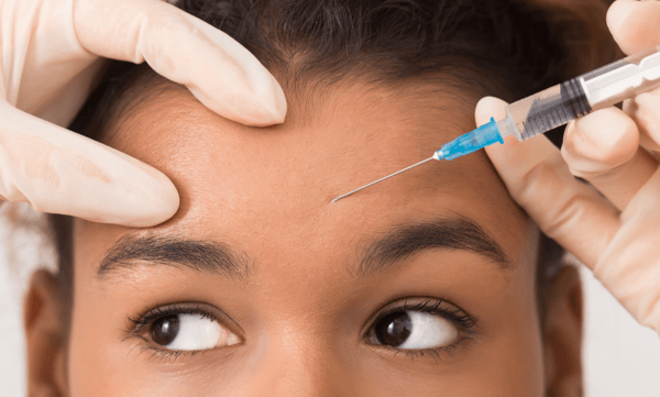 Botox Treatment Areas