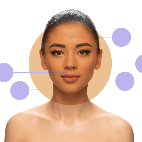 Acne Hack with Acne Mapping