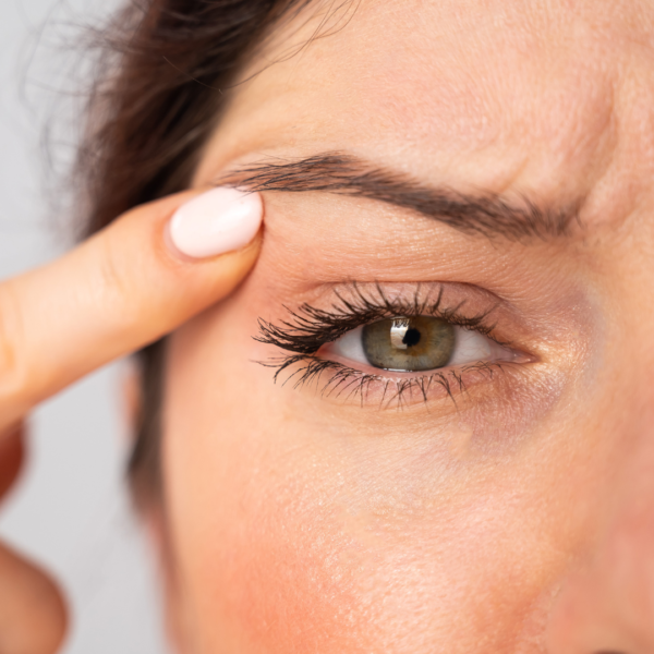 Is Eyelid Surgery Right for You?