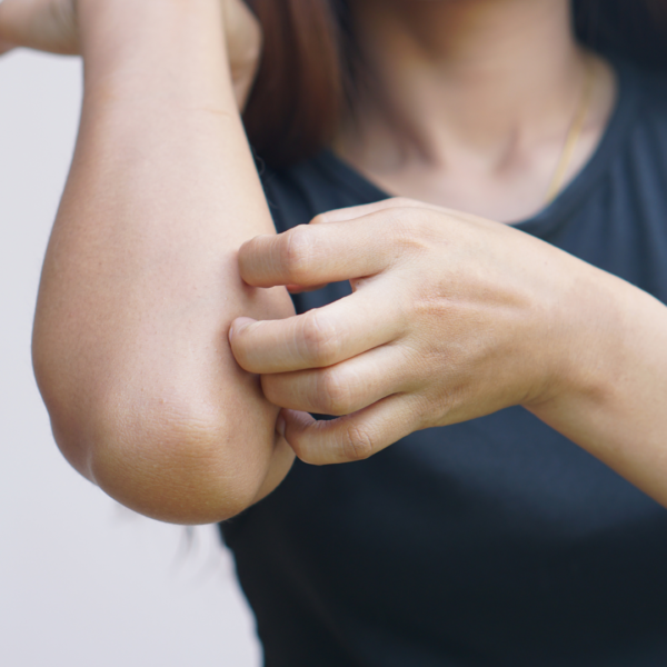 Is it Possible to Have a Rash You Can’t See? Itching without a Noticeable Rash