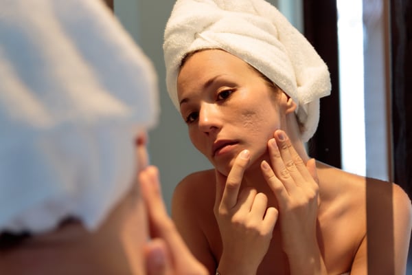 A Guide for Choosing the Best Facial Scar Treatment