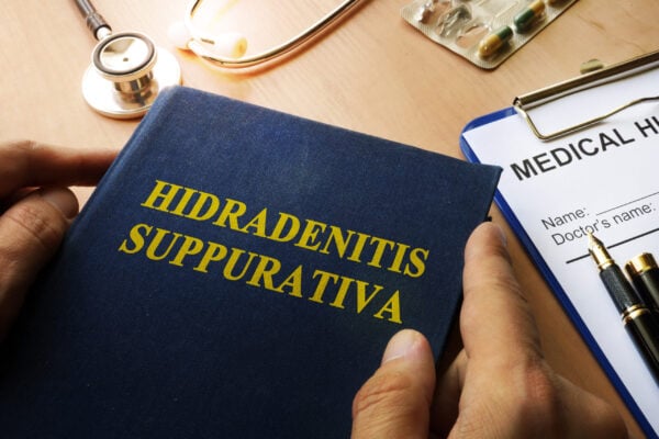 New Hope for Hidradenitis Suppurativa: Advancing Care with Compassion and Cutting-Edge Science