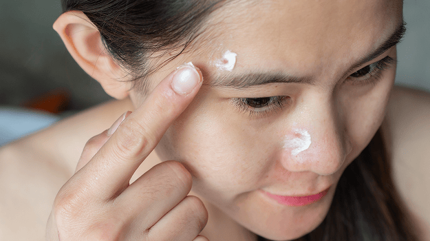 Person applying acne treatment