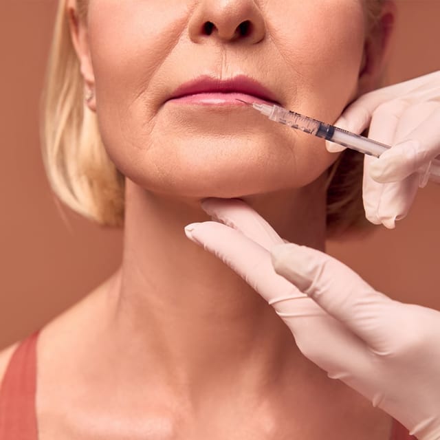 Dermal Fillers