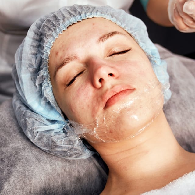 Mini-Melanage Peel