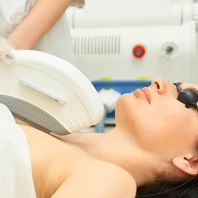 ND YAG Laser