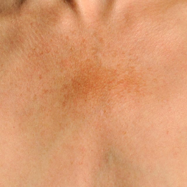 NEOCUTIS
