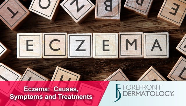 Eczema