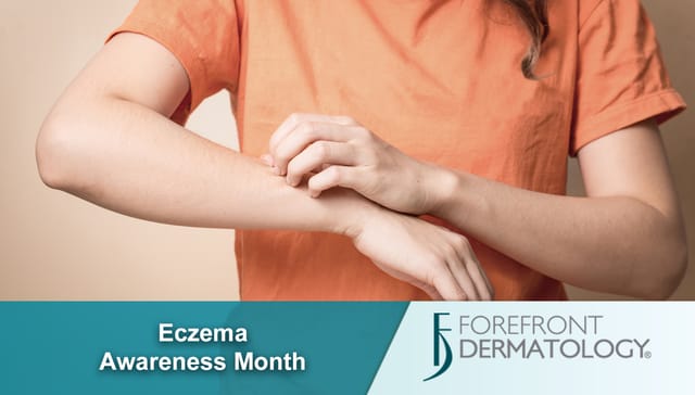 Eczema Awareness