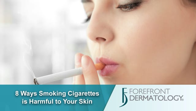 Cigarettes Skin