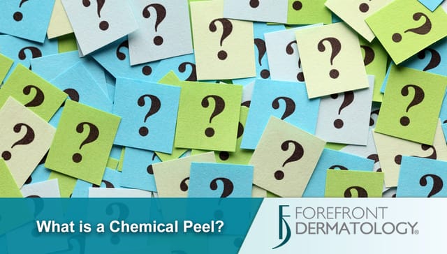 Chemical Peel