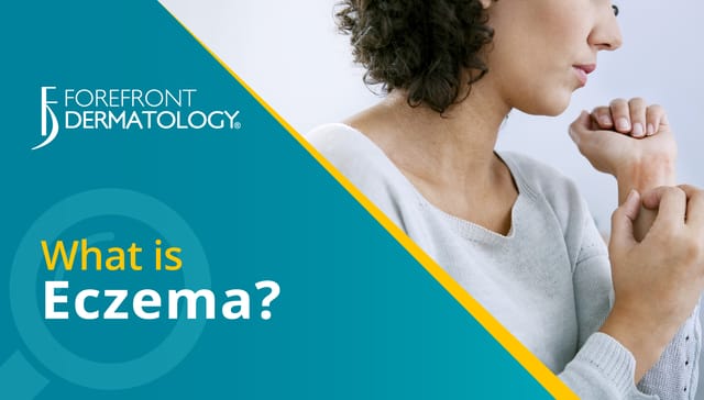 eczema