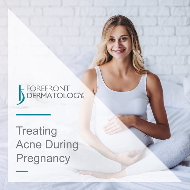 treating acne during pregnancy