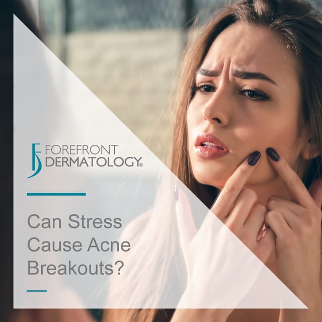 acne breakouts stress